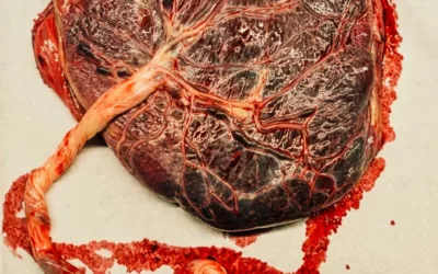 Le placenta dans l&rsquo;allaitement